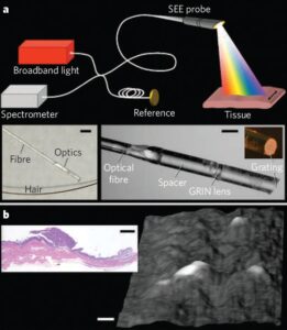 With SEE, polychromatic light emanating from a single optical fiber is configured such that each color (wavelength) is projected to a different location on the tissue surface (Fig. 1a). Photographs of a prototype miniature SEE probe are shown in the insets of Fig. 1a. A three-dimensional surface image of the parietal peritoneal wall, obtained with the SEE probe in vivo, is shown in Fig. 1b: several raised tumor nodules are evident and the inset shows a histological section.